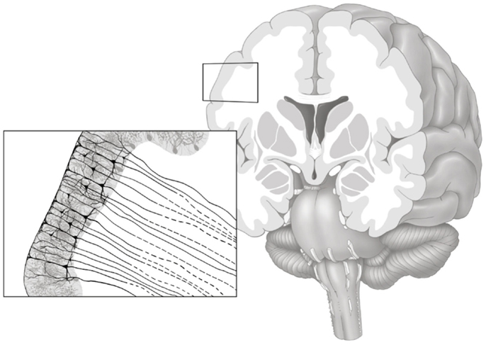 Diagram of a human brain, illustrating that the neuron cell bodies are mostly in the grey matter, and many of their axons extend through the white matter.