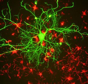 Cortical neuron tissue.