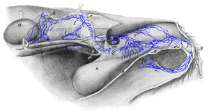 Drawing of the female reproductive organs with associated lymph nodes and lymphatic vessels.