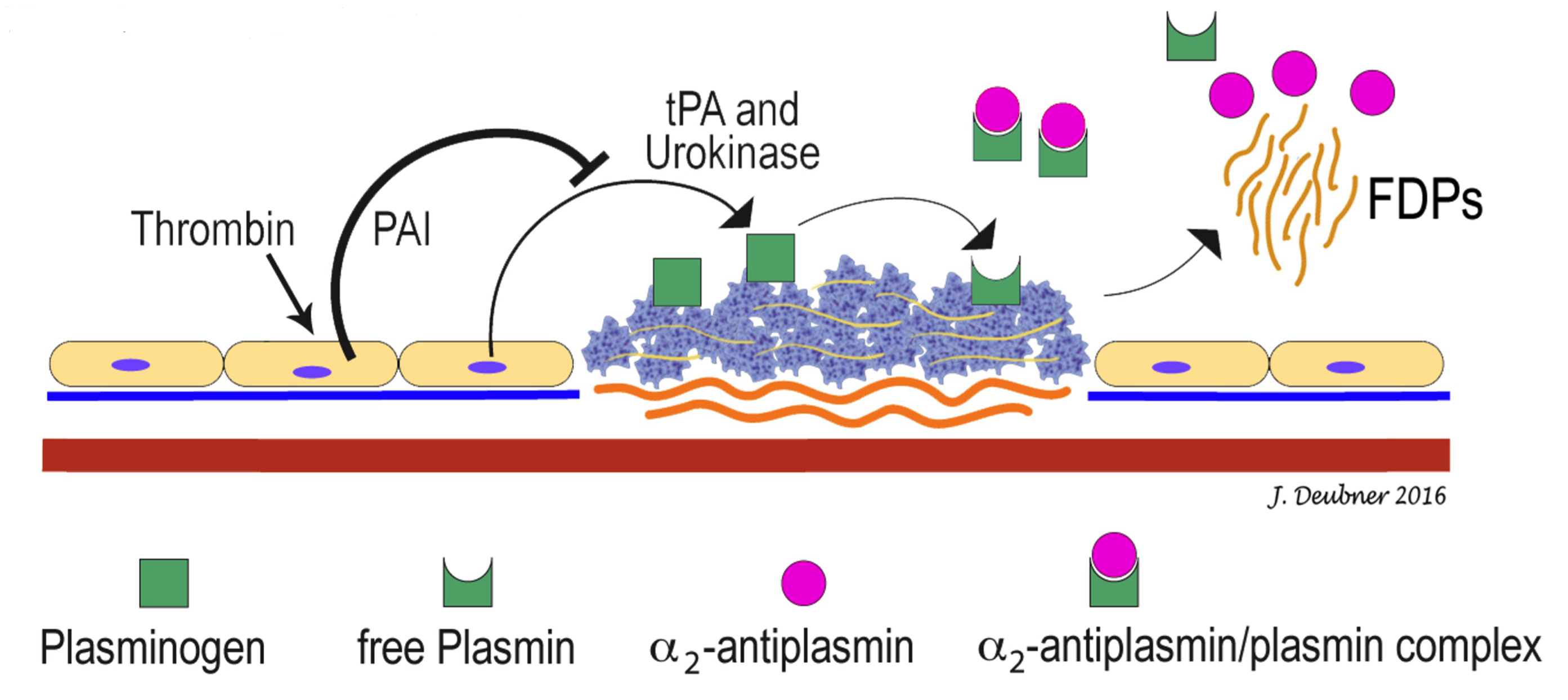 Figure 4.6 Fibrinolysis, illustrating plasminogen activators and inhibitors. Tissue plasminogen activator (tPA) and urokinase convert plasminogen to plasmin, the major proteolytic enzyme involved in the degradation of fibrin. Although thrombin activates endothelial cells to express a variety of mediators, including IPA, it also increases plasminogen activator inhibitor (PAI) production by endothelial cells, thereby playing dual roles in both promoting and inhibiting fibrinolysis. a,-antiplasmin is the primary inhibitor of plasmin and, therefore, plays an important role in regulating fibrinolysis. A deficiency of a,-antiplasmin results in a bleeding disorder due to premature fibrinolysis.FDPs=fibrin degradation products.