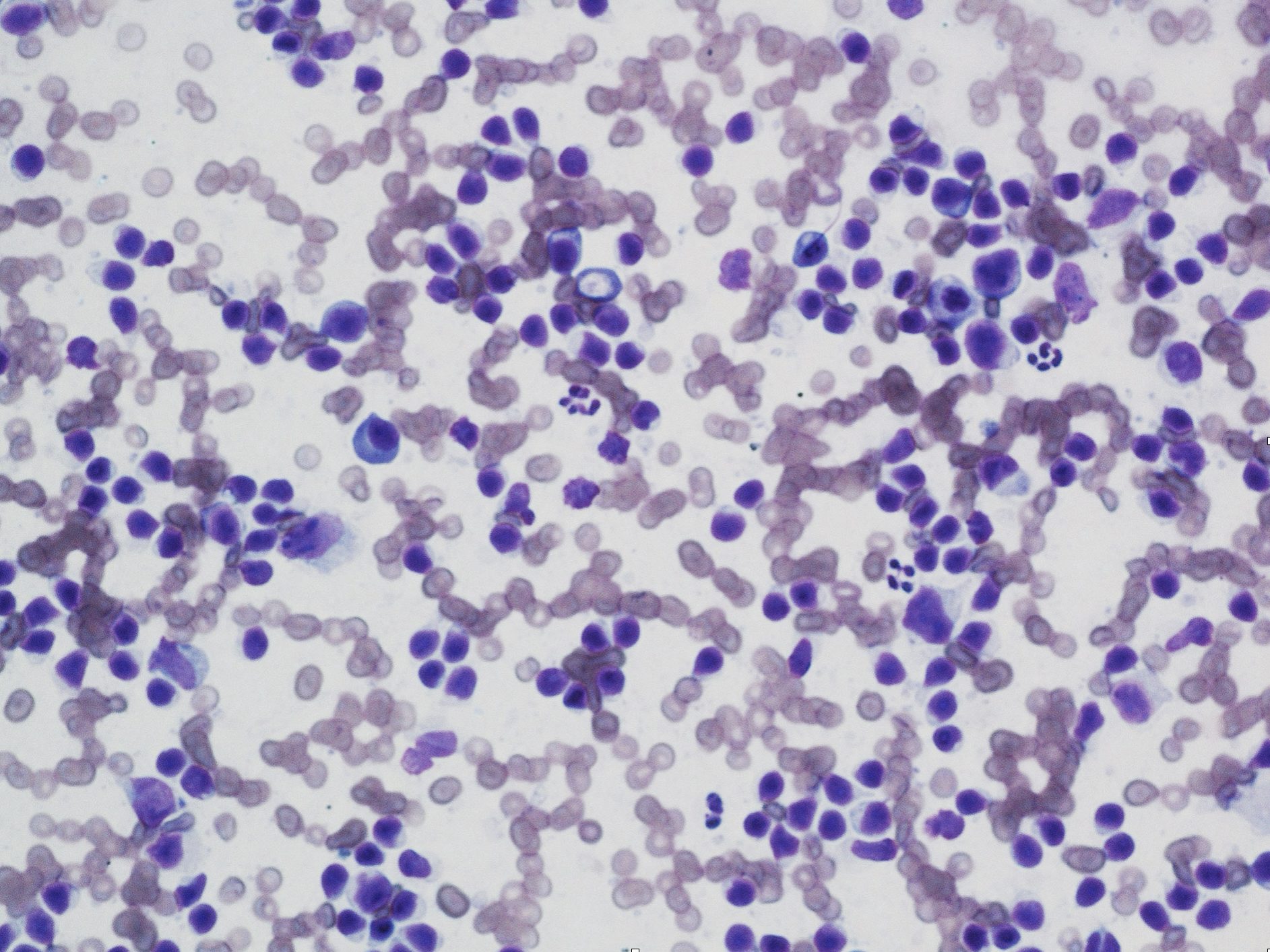 Figure 5.1 Abundant peripheral blood contamination in a cytology sample. Note numerous free erythrocytes admixed with the lymphocyte population. (Wright-Giemsa; IP.)