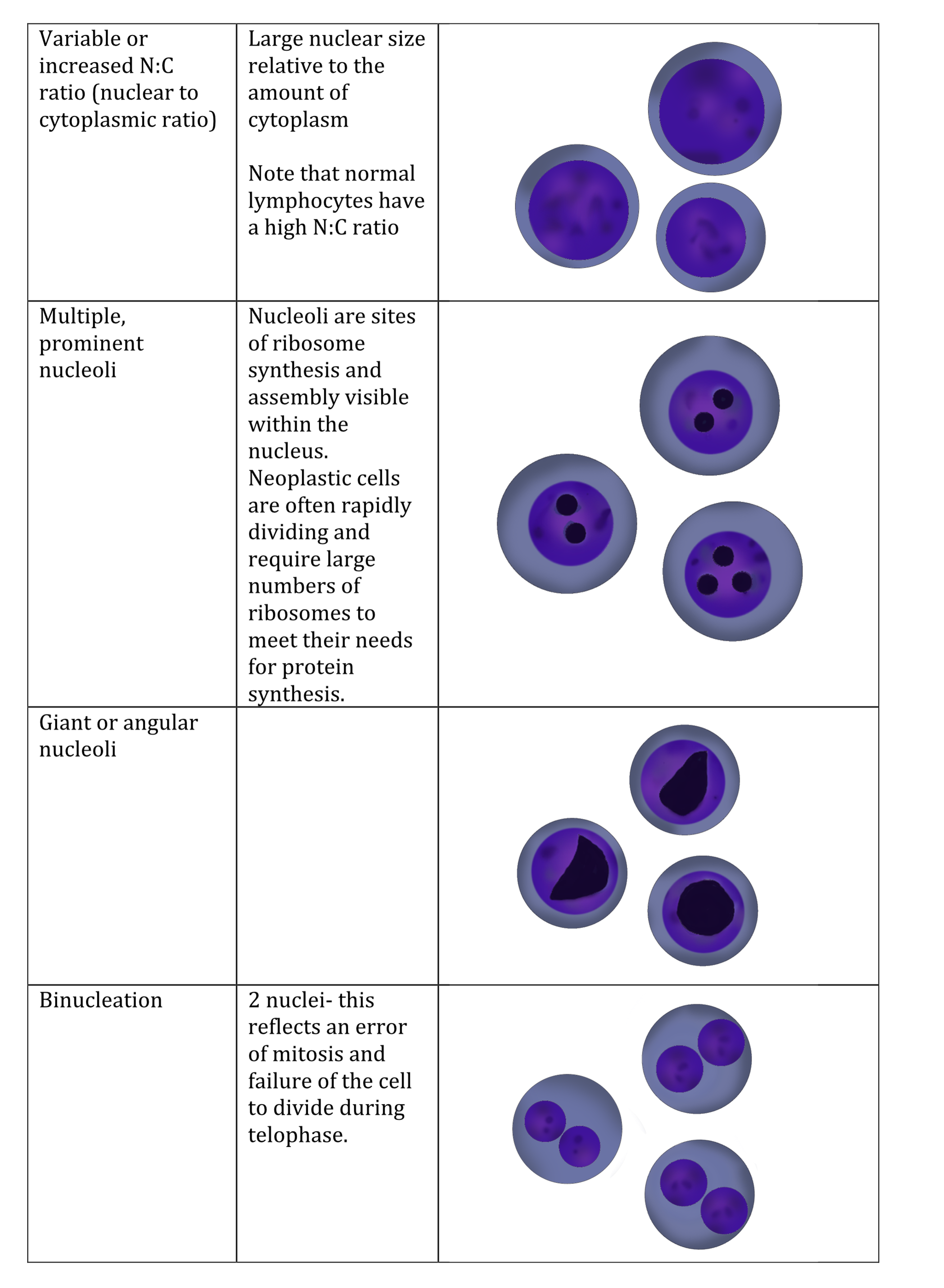 Fig 5.16 Line drawings of cytologic criteria of malignancy. (Courtesy of Dr. Juliane Deubner, Medical Illustrator, Western College of Veterinary Medicine, University of Saskatchewan).