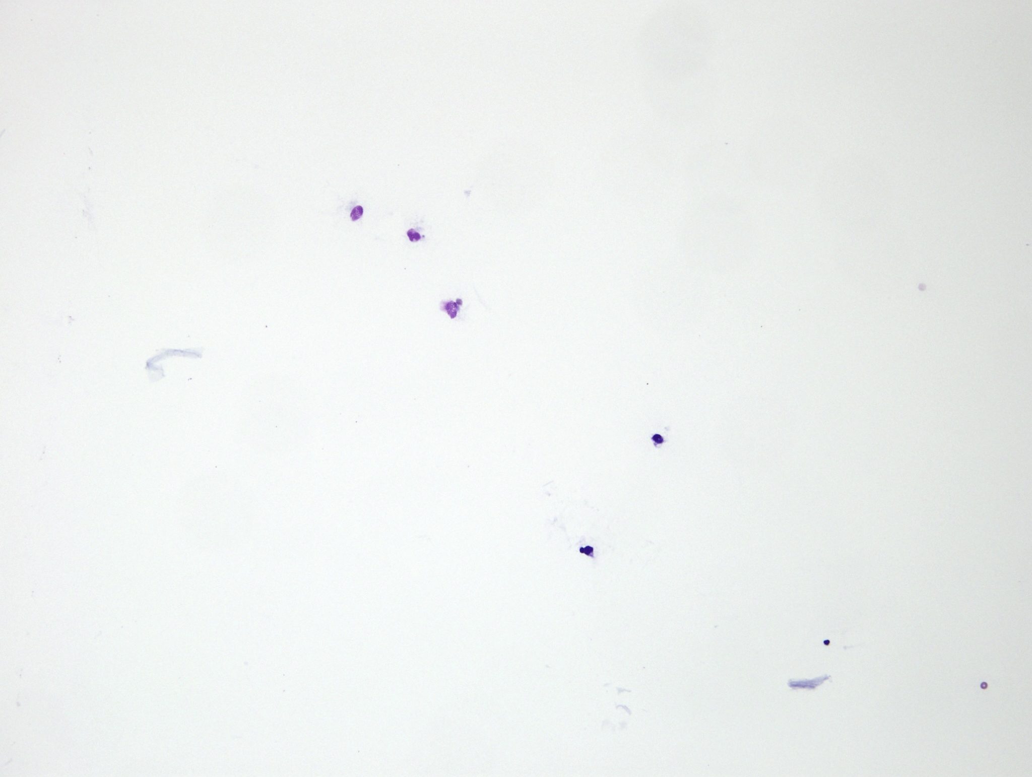Figure 5.31 Direct smear of a transudate. Note low cellularity. The clear background is typical of a low protein concentration. (Wright-Giemsa; LP.)