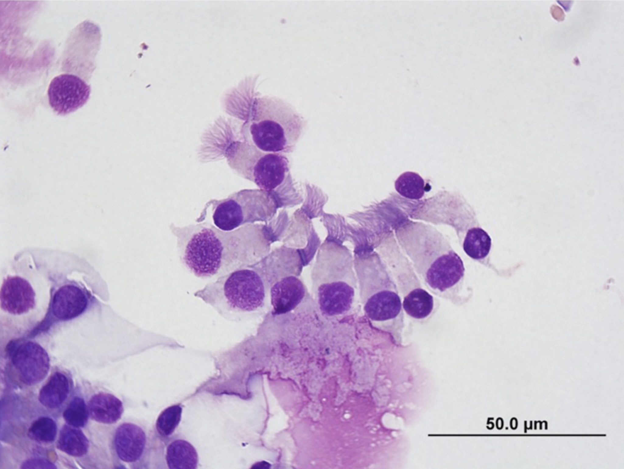 Figure 5.41 Ciliated columnar respiratory epithelial cells. Cells are from a normal tracheobronchial wash. (Wright-Giemsa; HP oil.)