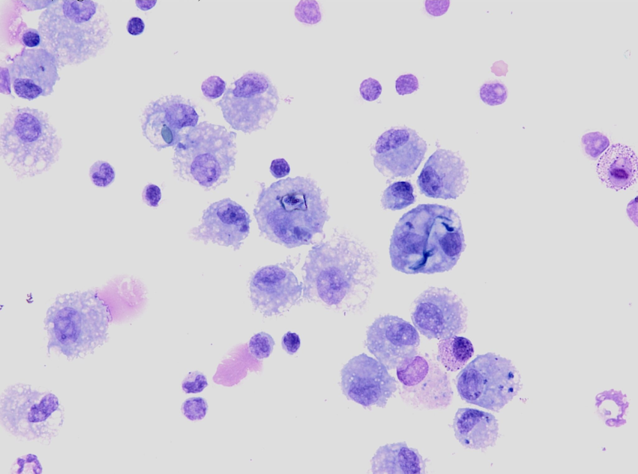 Figure 5.43 Phagocytosed material within macrophages. Sample is a bronchoalveolar wash from a horse. (Wright-Giemsa; HP oil.)
