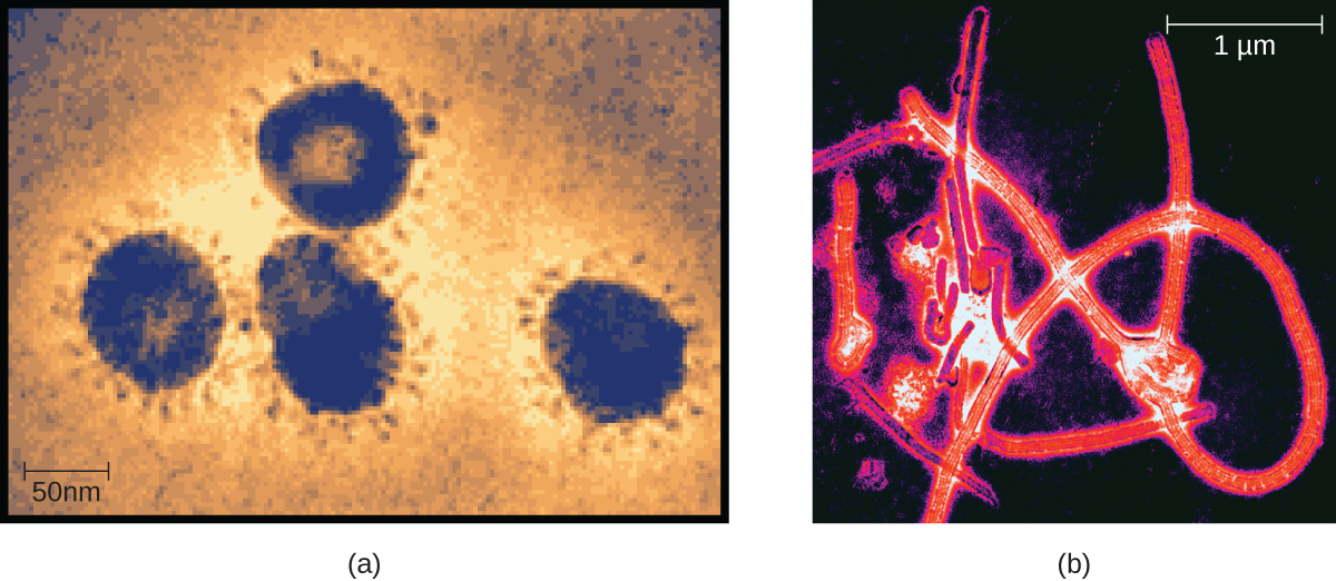 "Unknown" by CNX OpenStax is licensed under CC BY 4.0 Access for free at https://openstax.org/books/microbiology/pages/1-3-types-of-microorganisms Photos of viruses. The first photo shows members of the Coronavirus family. The second photo shows the Ebolavirus, a member of the Filovirus family.