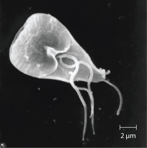 "Giardia lamblia SEM 8698 lores.jpg" by CDC/ Janice Haney Carr is licensed under CC0 Microphoto showing Giardia lamblia