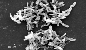 This work is a derivative of "Clostridium difficile 01.jpg" by Lois D Wiggs at Centers of Disease Control and Prevention is licensed under CC0 Photo of Clostridium difficile