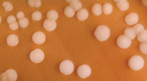 "OSC Microbio 04 02 Neisseria.jpg" by CNX OpenStax is licensed under CC BY 4.0 Access for free at https://openstax.org/books/microbiology/pages/4-2-proteobacteria Photo shoing Neisseria meningitidis growing in colonies on a chocolate agar plate