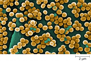This work is a derivative of "CDC-10046-MRSA.jpg" by Janice Haney Carr, Centers for Disease Control and Prevention is licensed under CC0 Photo of Staphylococcus auerus