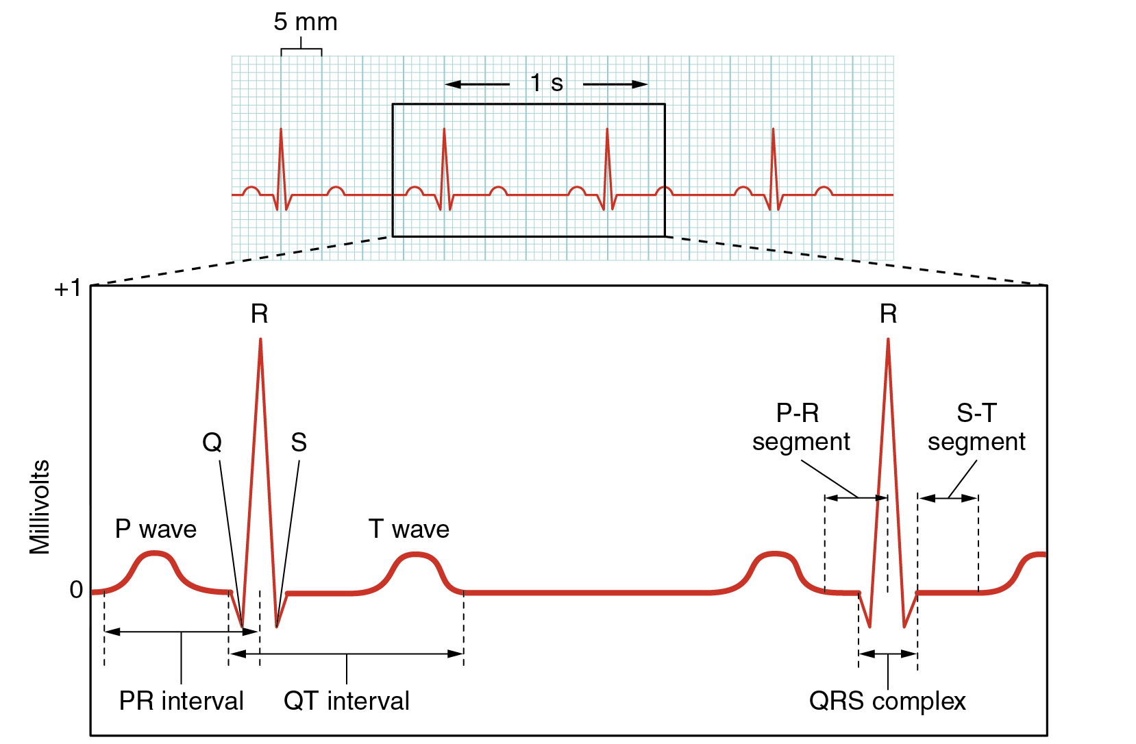 "Electrocardiogram Depolarization.jpg" by OpenStax College is licensed under CC BY 4.0 Access for free at https://openstax.org/books/anatomy-and-physiology/pages/19-2-cardiac-muscle-and-electrical-activity Illustration, with labels, showing an electrocardiogram tracing.