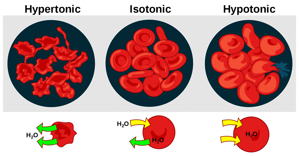 “Osmotic pressure on blood cells diagram.svg“ by LadyofHats is in the Public Domain Illustration showing Osmotic Effects of Hypertonic, Isotonic, and Hypotonic IV Fluids on Red Blood Cells