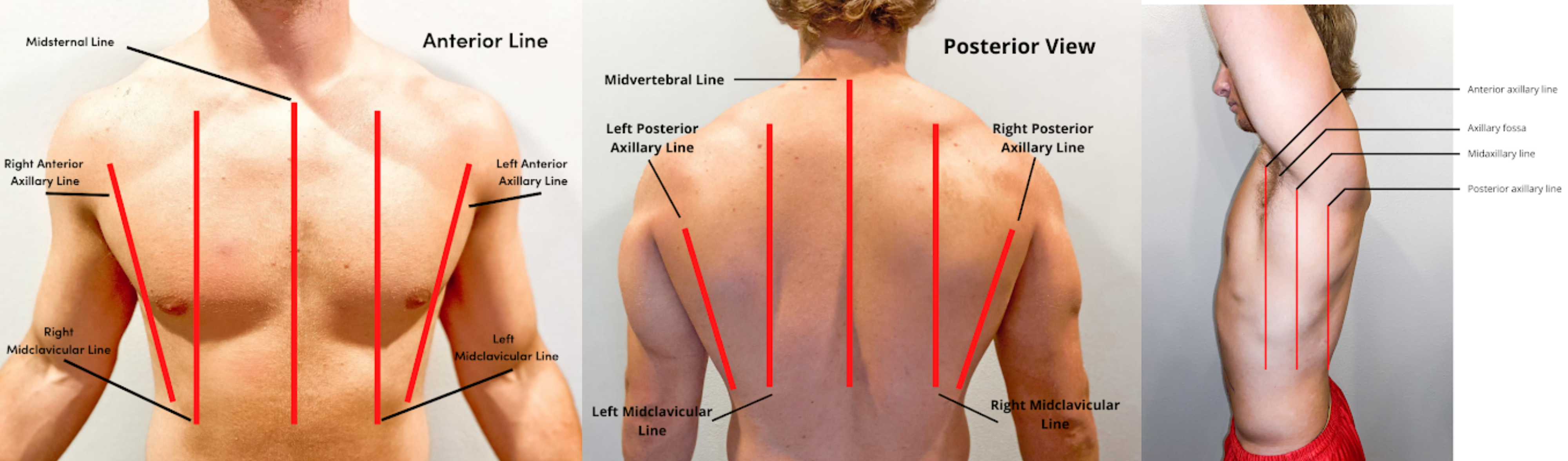 "Anterior_Chest_Lines.png", "Posterior_Chest_Lines.png", and "Lateral_Chest_Lines.png" by Meredith Pomietlo for Chippewa Valley Technical College is licensed under CC BY 4.0 Photo showing Landmarks of the Anterior, Posterior, and Lateral Thorax on human male