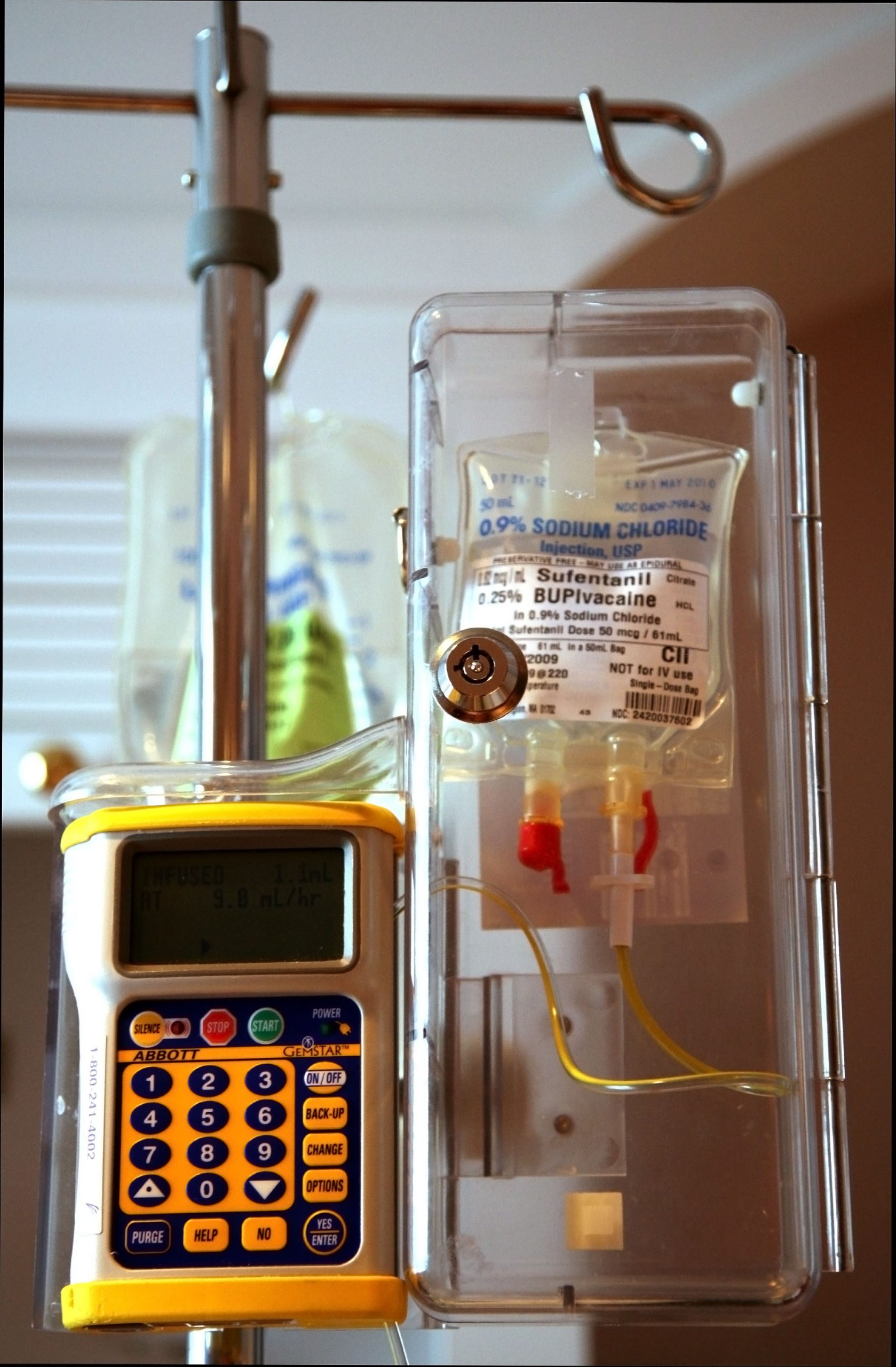 “EDK Pump 1.jpg” by Daniel Schwen is licensed under CC BY-SA 3.0 Photo showing an I V infusion pump
