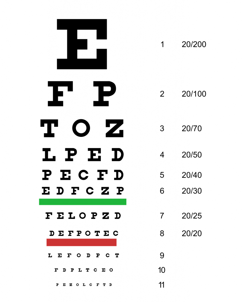 “Snellen chart.jpg” by Jeff Dahl is licensed under CC BY-SA 3.0 Image showing the Snellen Chart, used for assessing eye sight