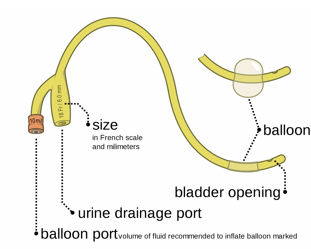 ”Foley catheter inflated and deflated EN.svg” by Olek Remesz (wiki-pl: Orem, commons: Orem) is licensed under CC BY-SA 3.0 Illustration showing Parts of an Indwelling Catheter, with labels