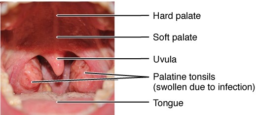 “2209 Location and Histology of Tonsils.jpg” by OpenStax College is licensed under CC BY 3.0 Access for free at https://openstax.org/books/anatomy-and-physiology/pages/21-1-anatomy-of-the-lymphatic-and-immune-systems Photo showing closeup on the back of mouth and throat, with labels
