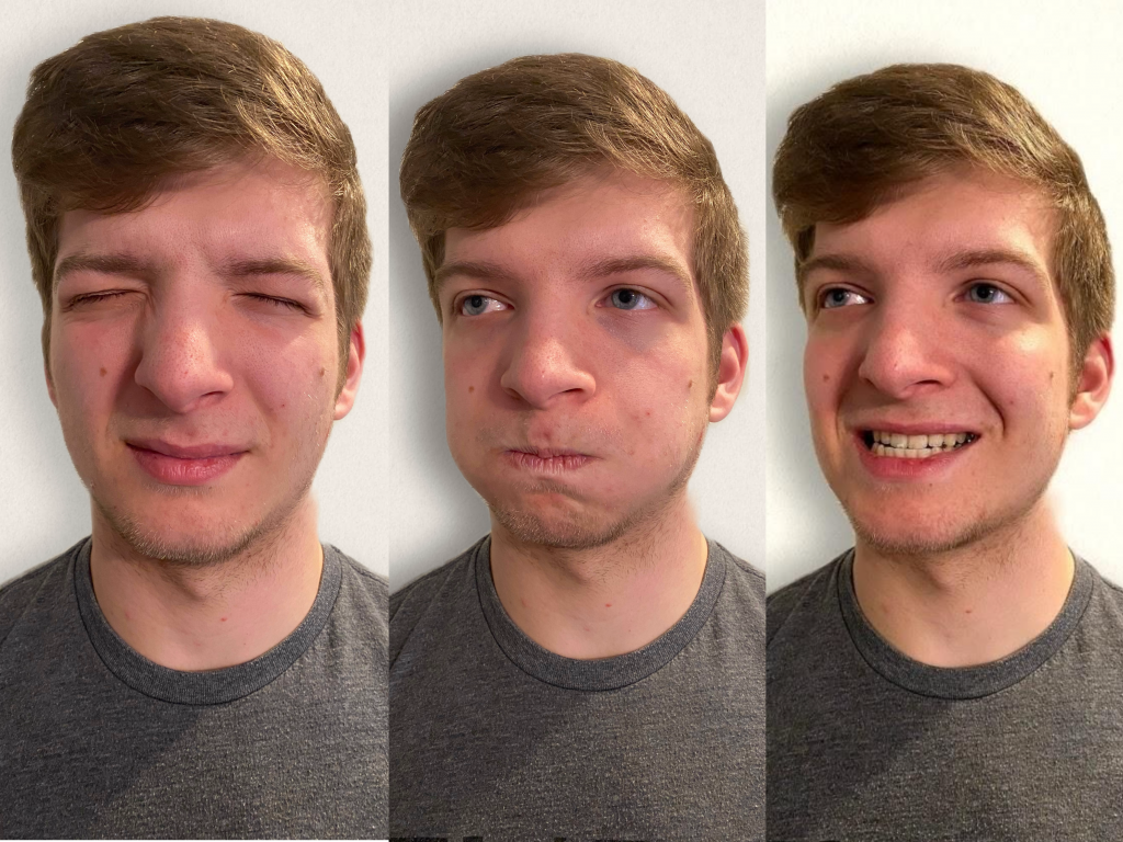 "Cranial Exam image 15.png", "Cranial Exam image 7.png", "Cranial Exam Image 10.png" by Meredith Pomietlo for Chippewa Valley Technical College is licensed under CC BY 4.0 Photo of simulated patient making three different faces