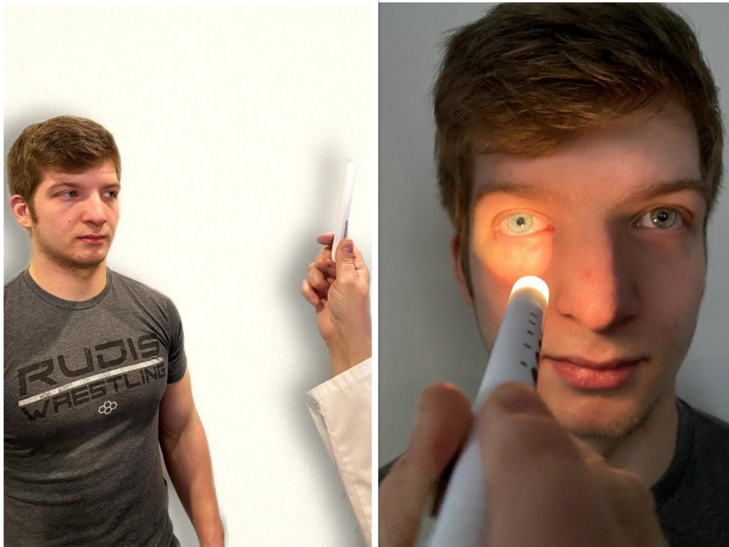 "Cranial Exam image 1" and "Pupillary Exam image 1" by Meredith Pomietlo for Chippewa Valley Technical College is licensed under CC BY 4.0 Photo showing assessment of simulated patient's pupil reaction to light source
