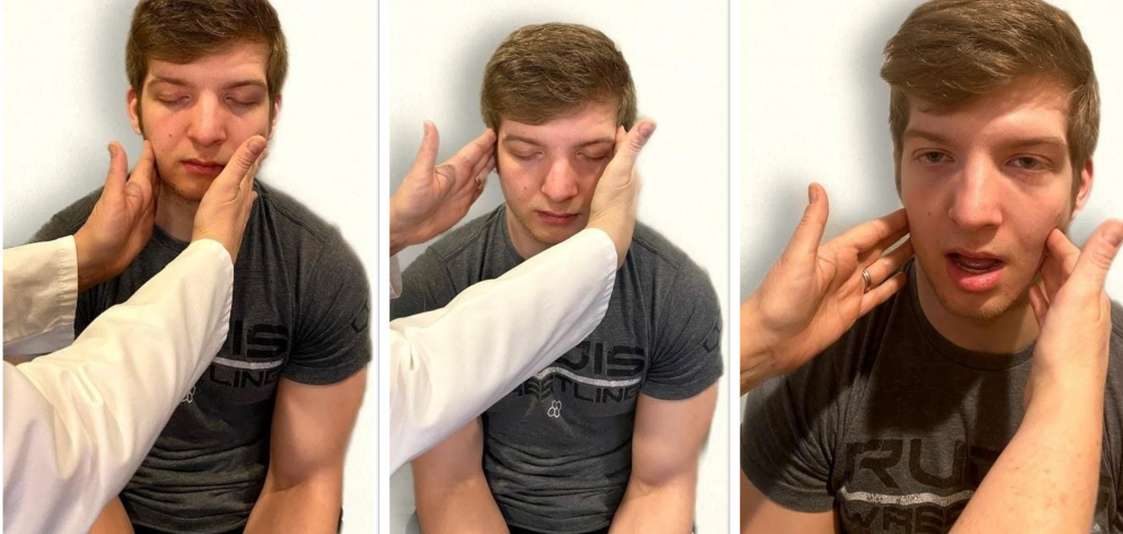 "Cranial Exam image 11", "Neuro Exam Image 35", and "Neuro Exam Image 4" by Meredith Pomietlo for Chippewa Valley Technical College is licensed under CC BY 4.0 Photo showing simulated patient being assessed for trigeminal motor function