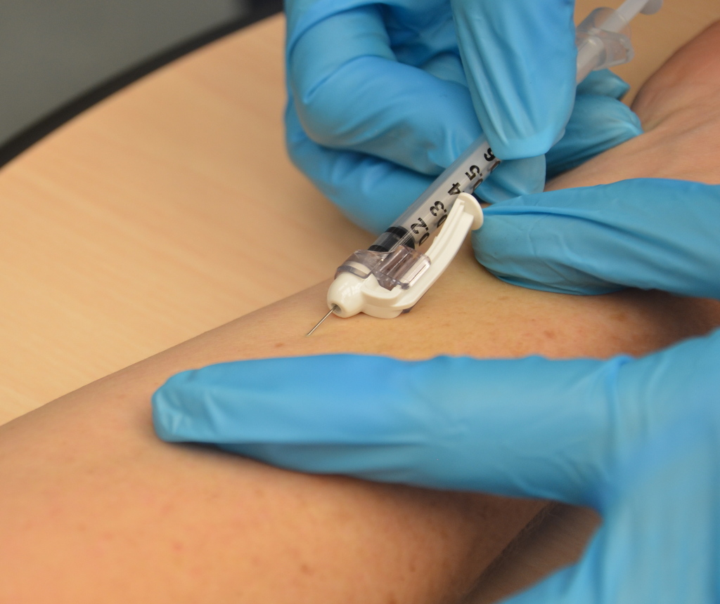 “:Intradermal_injection.jpg“ by British Columbia Institute of Technology (BCIT) is licensed under CC BY 4.0. Access for free at https://opentextbc.ca/clinicalskills/chapter/6-7-intradermal-subcutaneous-and-intramuscular-injections/ Photo demonstrating intradermal injection