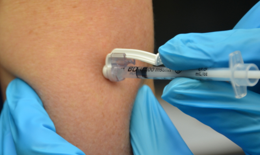 “Book-pictures-2015-650.jpg” by British Columbia Institute of Technology (BCIT) is licensed under CC BY 4.0. Access for free at https://opentextbc.ca/clinicalskills/chapter/6-7-intradermal-subcutaneous-and-intramuscular-injections/ Photo showing closeup of subcutaneous injection