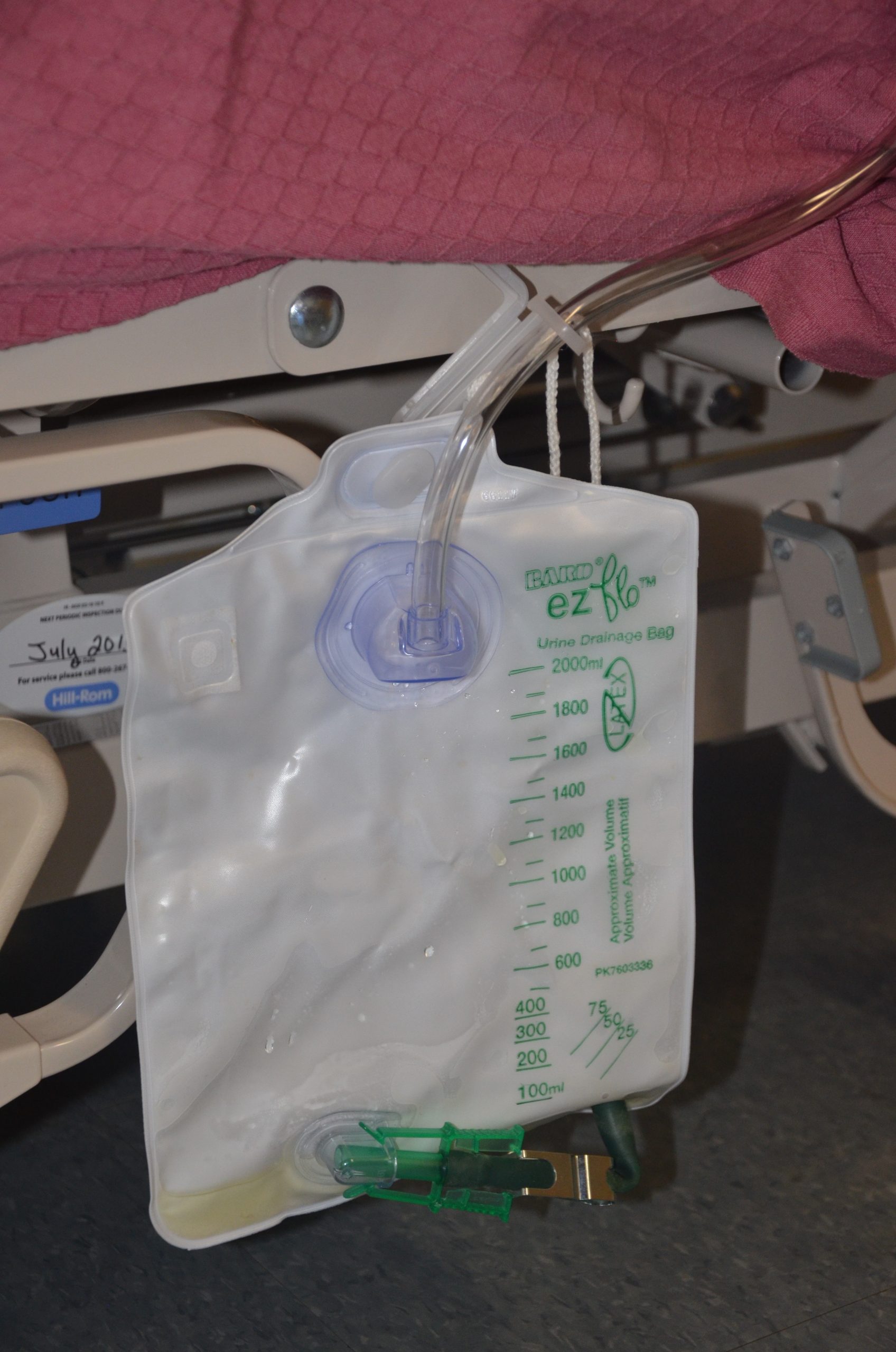 ”DSC_2104.jpg” by British Columbia Institute of Technology (BCIT) is licensed under CC BY 4.0. Access for free at https://ecampusontario.pressbooks.pub/clinicalskills/chapter/2-2-head-to-toe-assessment-checklist/ Photo showing a urine collection bag