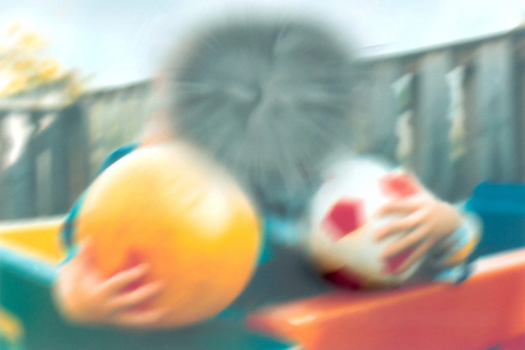 “Eye disease simulation, age-related macular degeneration.jpg” by National Eye Institute, National Institutes of Health is in the Public Domain Photo of children, holding balls, adjusted to simulated macular degeneration