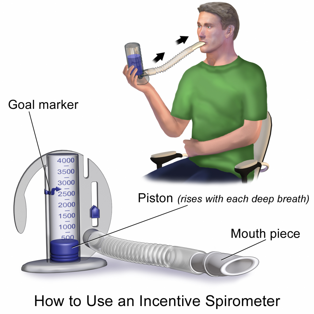 “Incentive Spirometer.pngsommeil.svg” by BruceBlaus is licensed under CC BY-SA 4.0 Illustration of person using an incentive spirometer, with labels