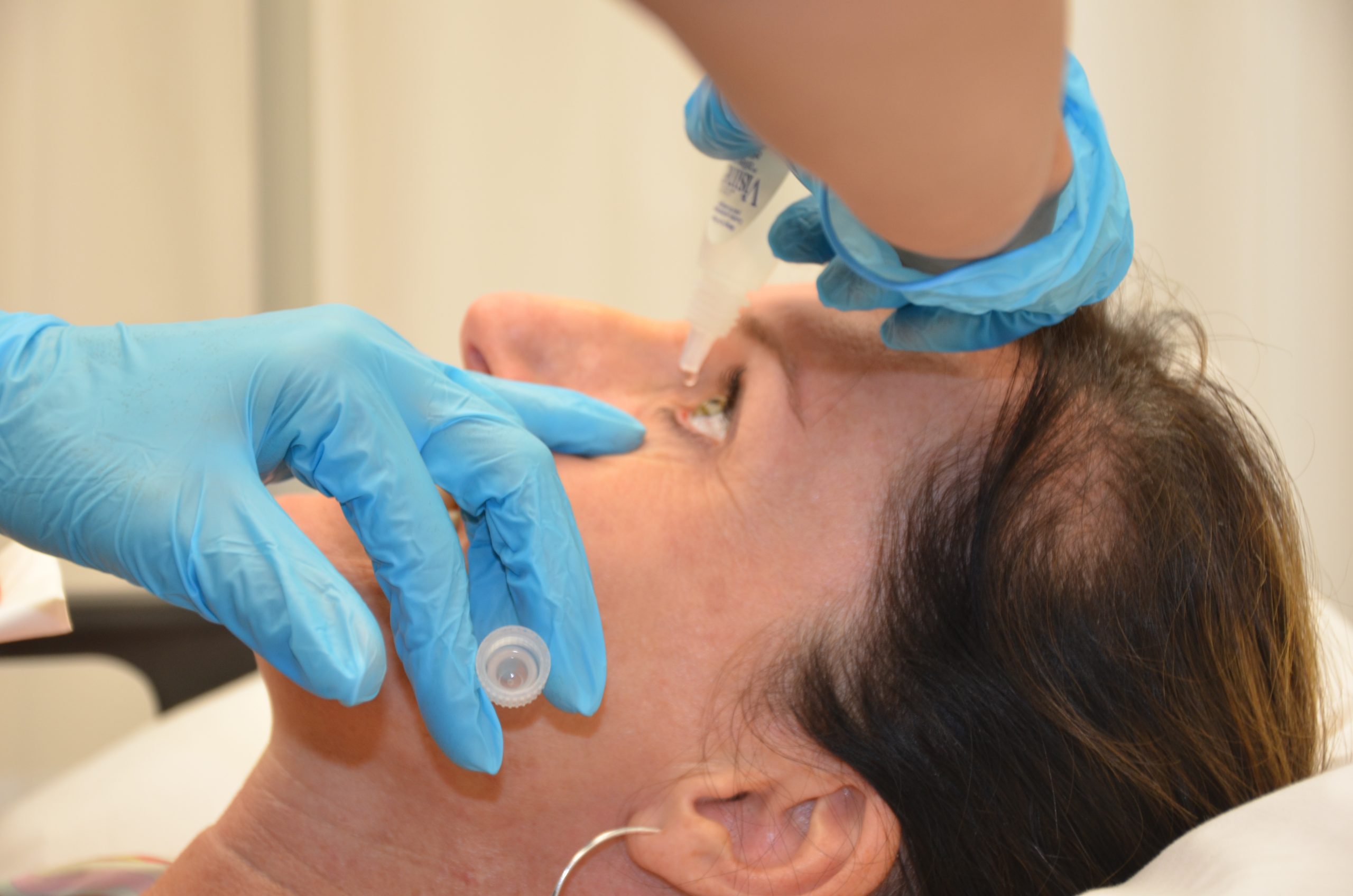 “Instilling eye medication” by British Columbia Institute of Technology (BCIT) is licensed under CC BY 4.0. Access for free at https://opentextbc.ca/clinicalskills/chapter/6-5-installing-eye-ear-and-nose-medications/ . Photo showing administration of eye drops