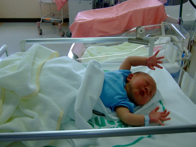 “Moro reflex.jpg” by tawamie is licensed under CC BY-SA 3.0 Photo showing an infant with arms jerks up and out, palms up in reaction to a loud noise