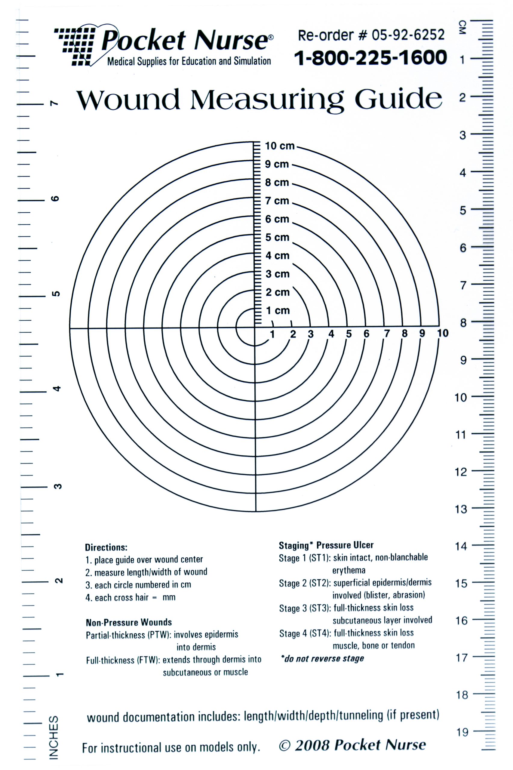 "Sample Wound Measuring Guide.jpg" by Deanna Hoyord, Chippewa Valley Technical College is licensed under CC BY 4.0 Photo showing a wound measurement tool