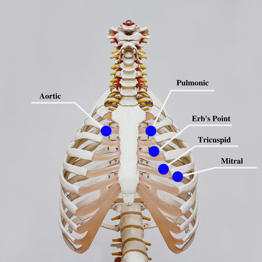 “Anteriopoterior View of Major Precordial Areas” by Meredith Pomietlo for Chippewa Valley Technical College is licensed under CC BY 4.0 Image showing major precordial areas, with labels