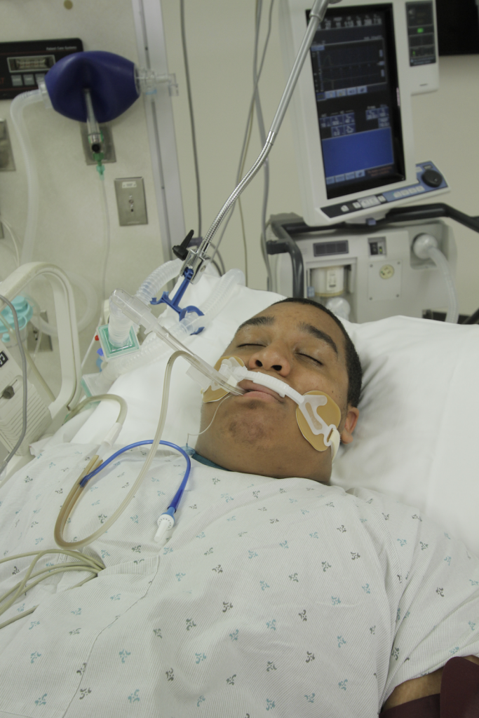 “Simulated intubated patient on a mechanical Ventilator” by ARISE project for Chippewa Valley Technical College is licensed under CC BY 4.0 Photo of a Simulated Intubated Patient on a Mechanical Ventilator