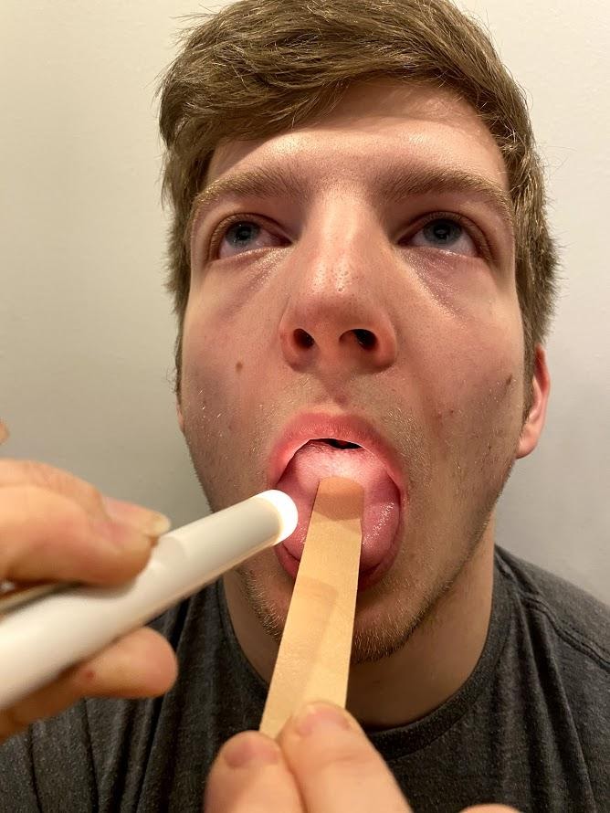 "Oral Exam Image 2.png" by Meredith Pomietlo for Chippewa Valley Technical College is licensed under CC BY 4.0 Photo of simulated patient having mouth examined