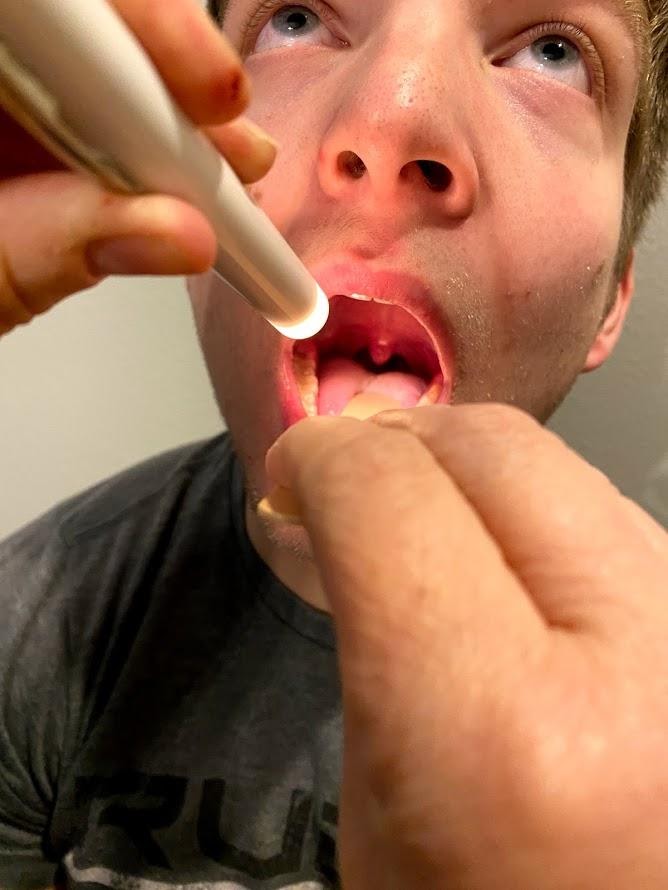 "Oral Exam.png" by Meredith Pomietlo for Chippewa Valley Technical College is licensed under CC BY 4.0 Photo showing simulated patient having mouth and throat examined
