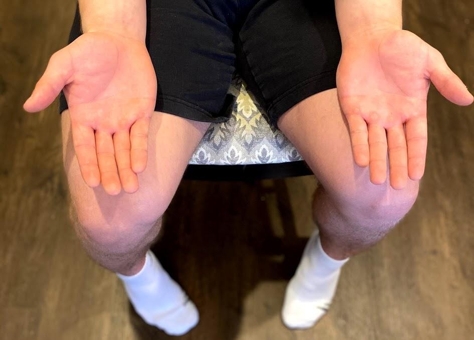 "Neuro Exam image 20.png"by Meredith Pomietlo for Chippewa Valley Technical College is licensed under CC BY 4.0 Photo showing a person sitting with hands on thighs, palms up