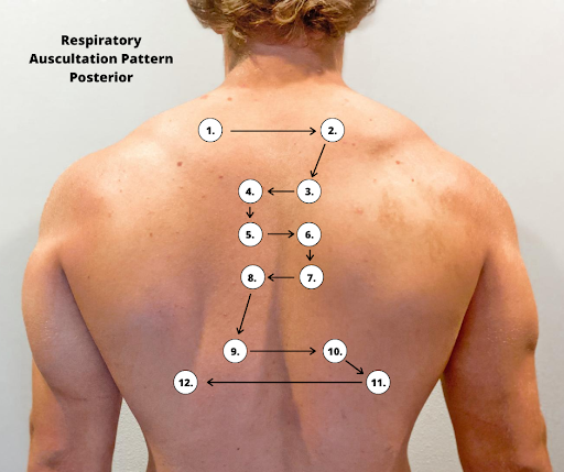 "Posterior Respiratory Auscultation Pattern.png" by Meredith Pomietlo for Chippewa Valley Technical College is licensed under CC BY 4.0 Photo showing Posterior Auscultation Areas