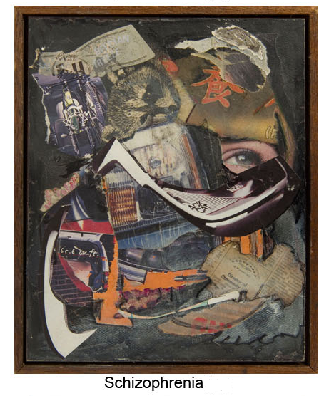”Schizophrenia.png” by William A. Ursprung is in the Public Domain Image showing Schizophrenia art piece by William A. Ursprung