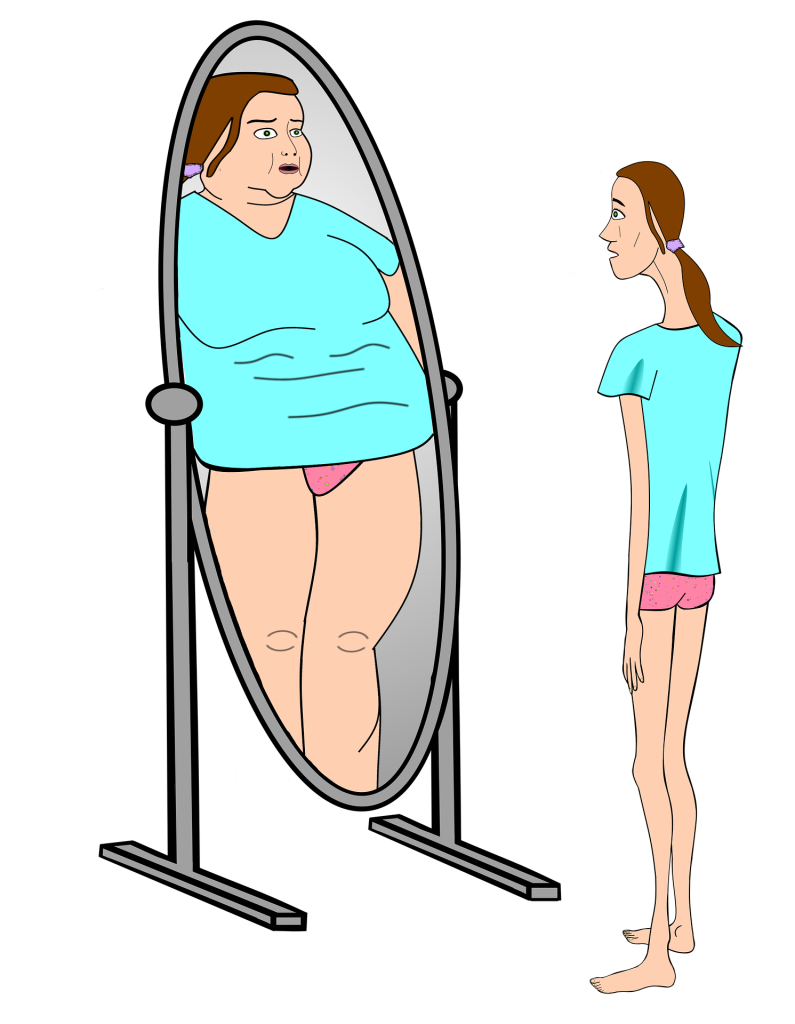 “maxpixel.net/Bulimia-Anorexia-Nervosa-Skimmed-Delusional-4049661.png” by unknown author is licensed under CC0. Illustration showing a thin person looking into a mirror and seeing themselves as much larger to show Body Perception of a Person With Anorexia Nervosa